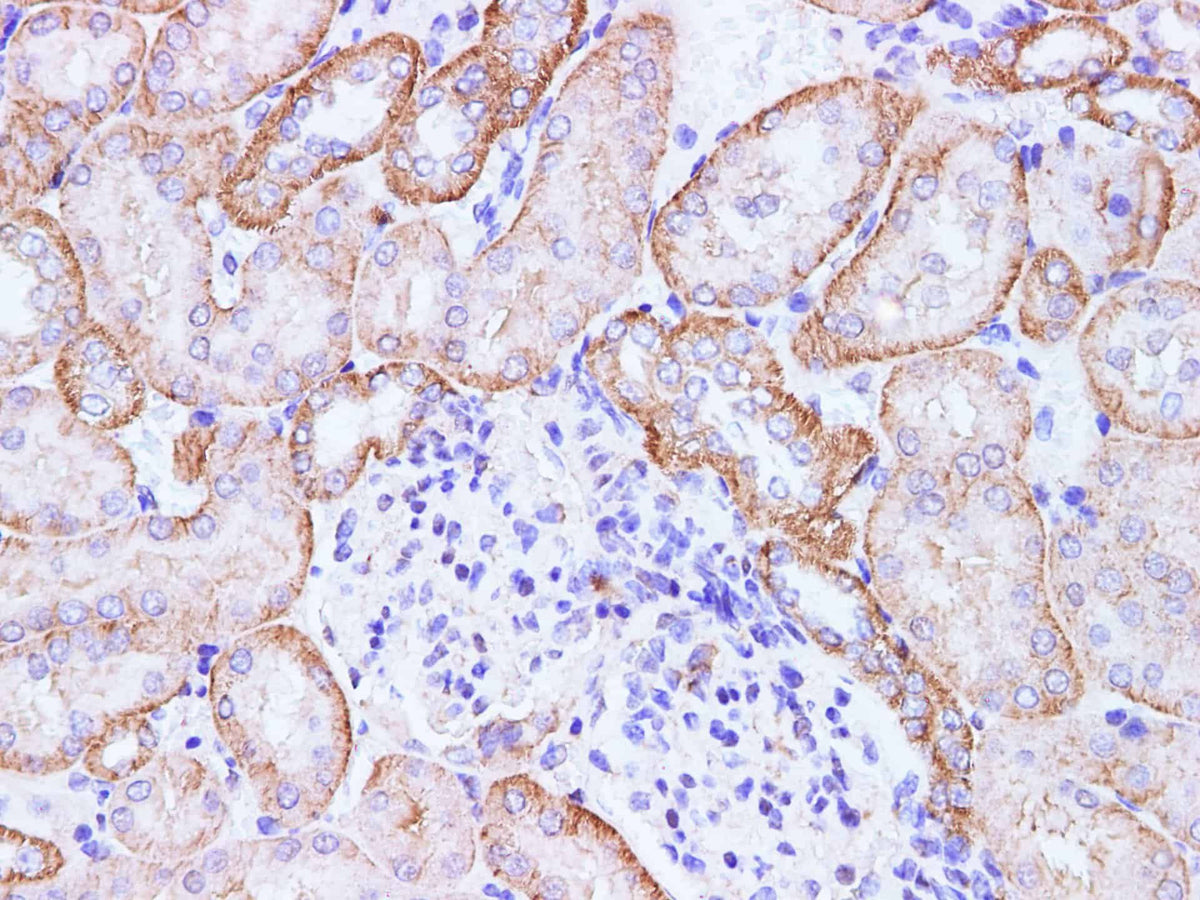 CCL2 Polyclonal Antibody Host Rabbit