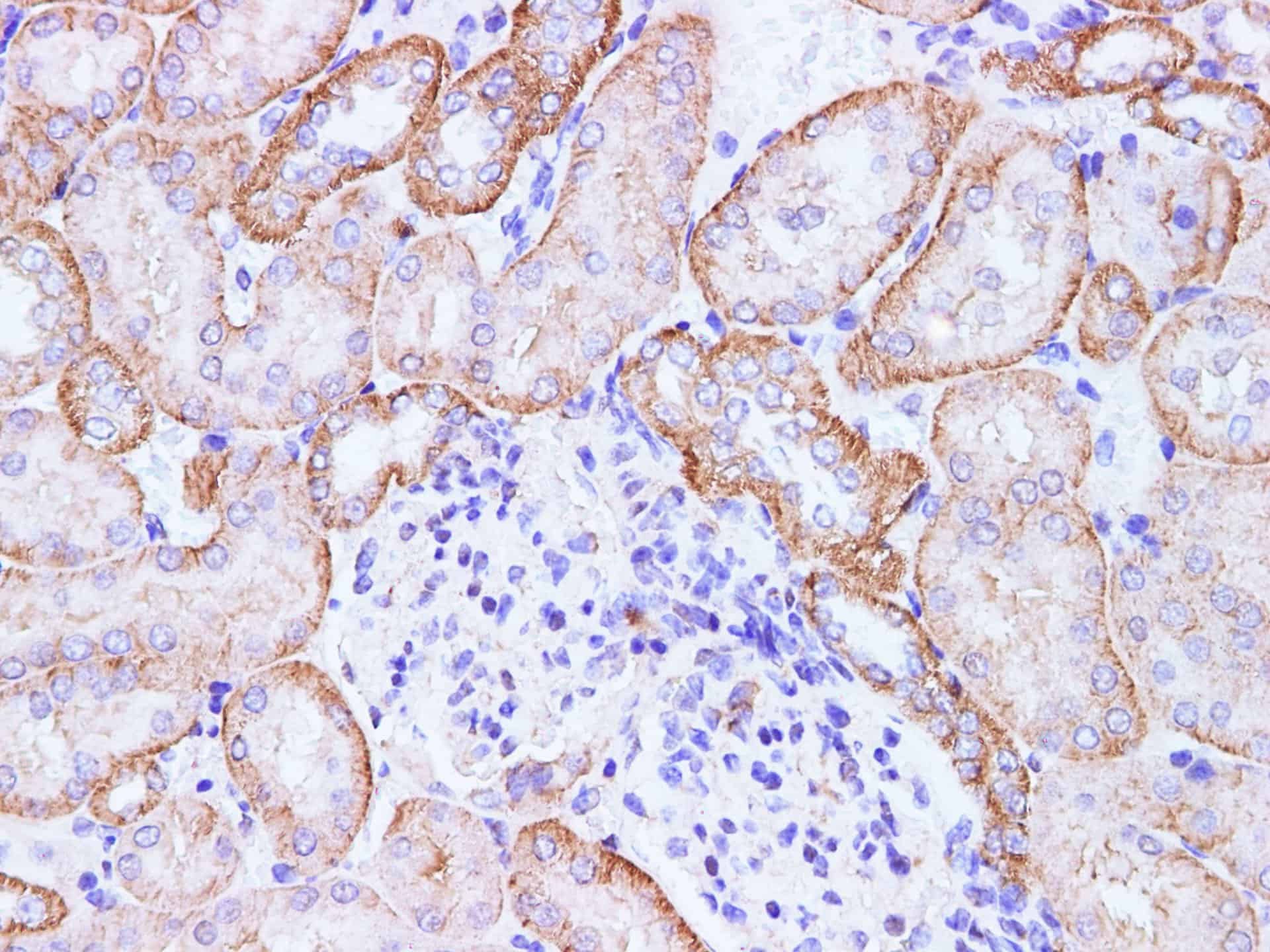 CCL2 Polyclonal Antibody Host Rabbit
