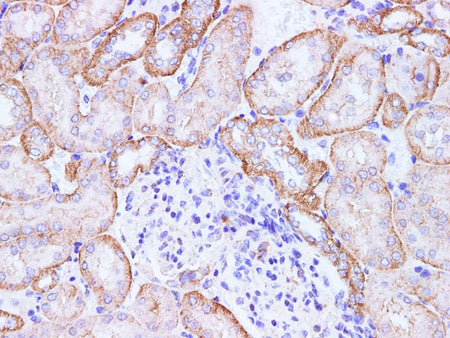 CCL2 Polyclonal Antibody Host Rabbit