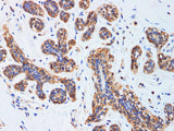 CCL2 Polyclonal Antibody Host Rabbit
