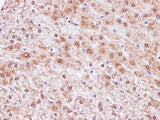 CCL2 Polyclonal Antibody Host Rabbit