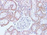 CCL2 Polyclonal Antibody Host Rabbit