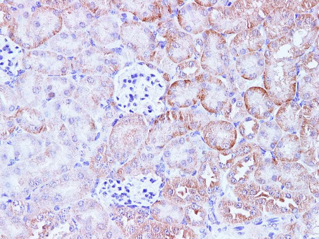 CCL2 Polyclonal Antibody Host Rabbit