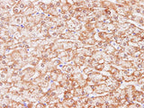 CCL2 Polyclonal Antibody Host Rabbit