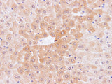 IL2 Polyclonal Antibody Host Rabbit