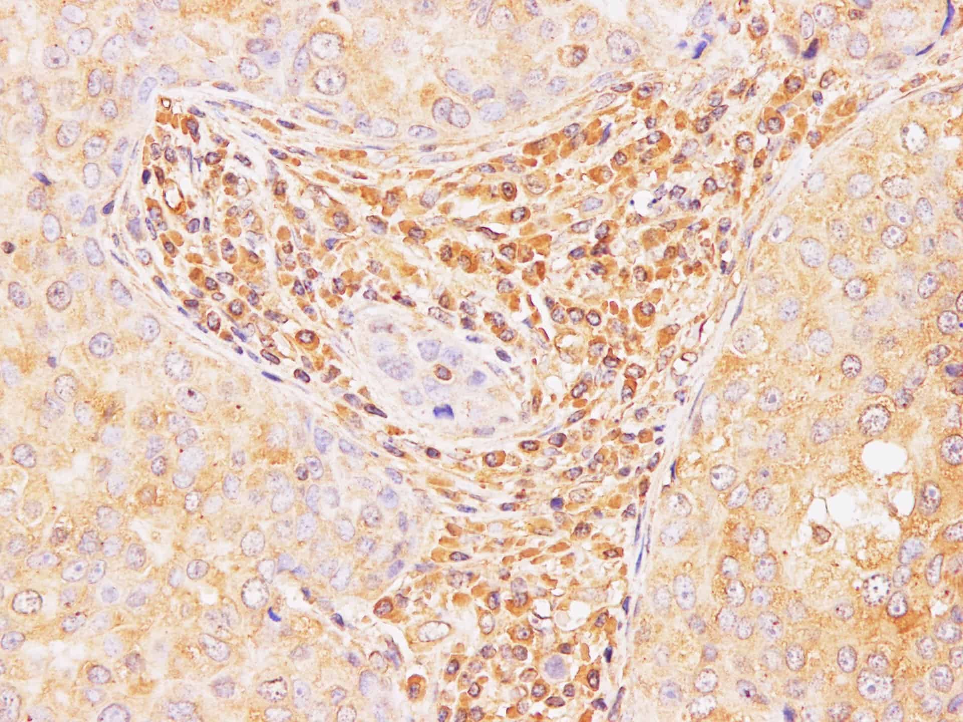 IL2 Polyclonal Antibody Host Rabbit