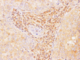 IL2 Polyclonal Antibody Host Rabbit