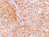 IL2 Polyclonal Antibody Host Rabbit