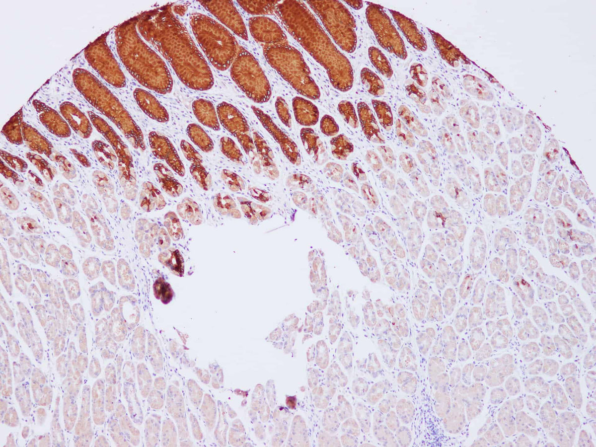 MUC5AC Polyclonal Antibody Host Rabbit