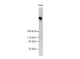 BRCA2 Polyclonal Antibody Host Rabbit