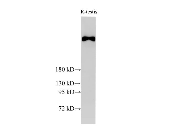 BRCA2 Polyclonal Antibody Host Rabbit