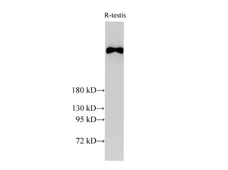 BRCA2 Polyclonal Antibody Host Rabbit