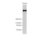 BRCA2 Polyclonal Antibody Host Rabbit