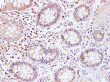 BRCA2 Polyclonal Antibody Host Rabbit