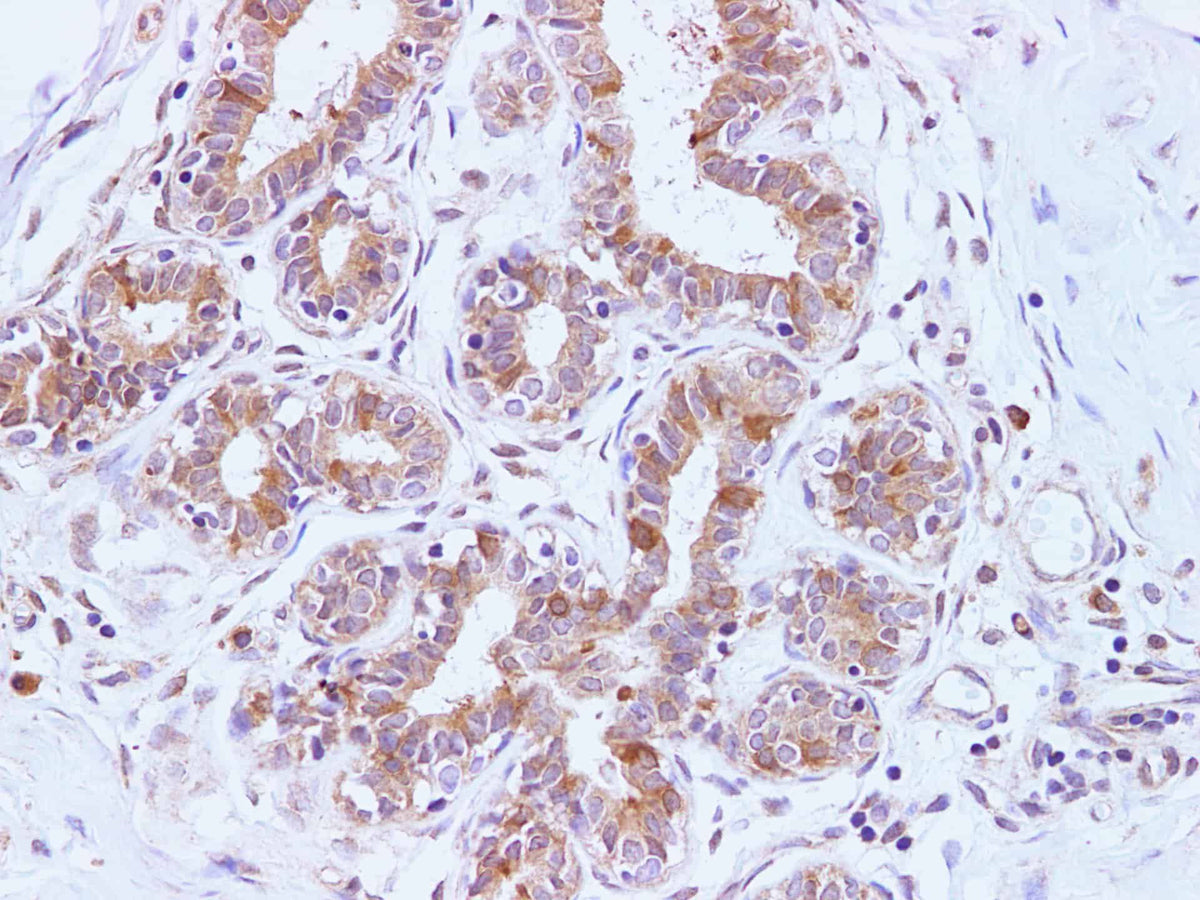 BRCA2 Polyclonal Antibody Host Rabbit