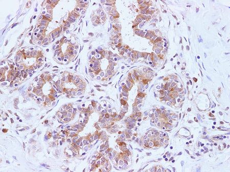 BRCA2 Polyclonal Antibody Host Rabbit