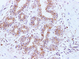 BRCA2 Polyclonal Antibody Host Rabbit
