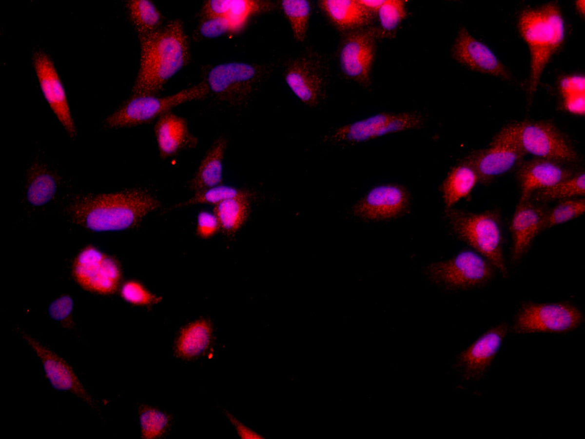 BRCA2 Polyclonal Antibody Host Rabbit