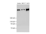 BRCA2 Polyclonal Antibody Host Rabbit