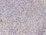 AFP Polyclonal Antibody Host Rabbit