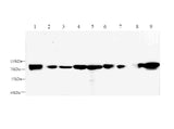 AFP Polyclonal Antibody Host Rabbit