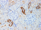 KLK10 Polyclonal Antibody Host Rabbit