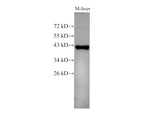 EpCAM Polyclonal Antibody