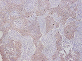 EpCAM Polyclonal Antibody