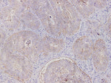 EpCAM Polyclonal Antibody
