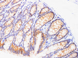 EpCAM Polyclonal Antibody