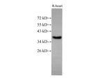 EpCAM Polyclonal Antibody