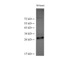 ADIPOQ Polyclonal Antibody Host Rabbit