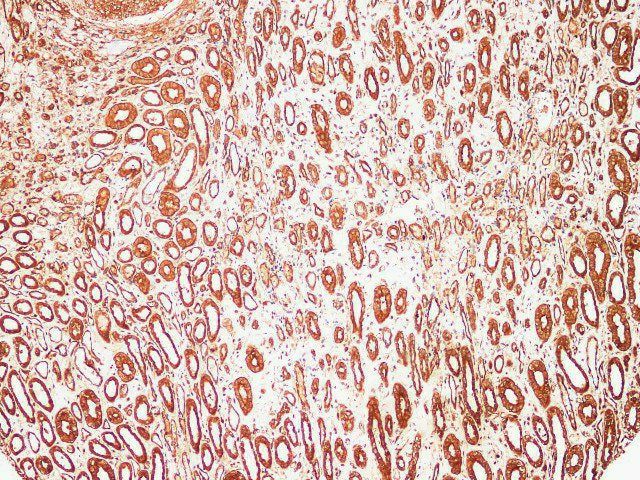 S100A9 Polyclonal Antibody Host Rabbit