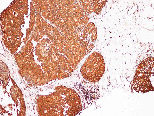 S100A9 Polyclonal Antibody Host Rabbit