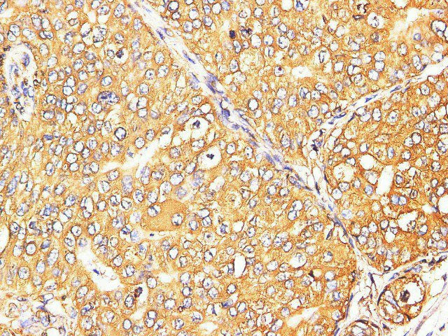 S100A9 Polyclonal Antibody Reactivity Mouse