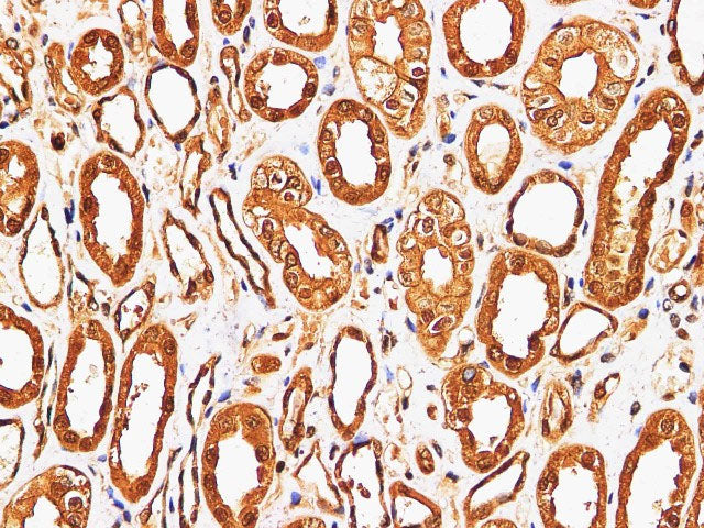 S100A9 Polyclonal Antibody Reactivity Mouse