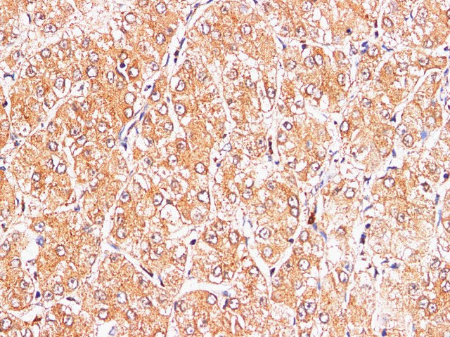 S100A9 Polyclonal Antibody Reactivity Mouse