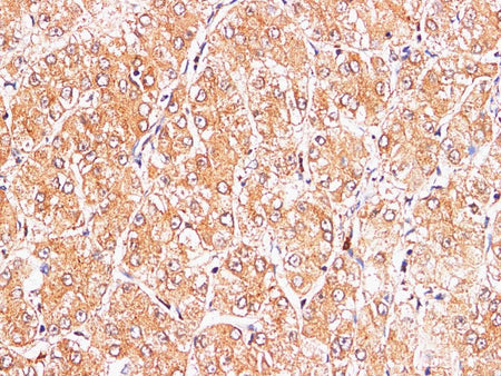 S100A9 Polyclonal Antibody Reactivity Mouse