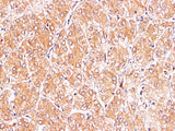 S100A9 Polyclonal Antibody Reactivity Mouse
