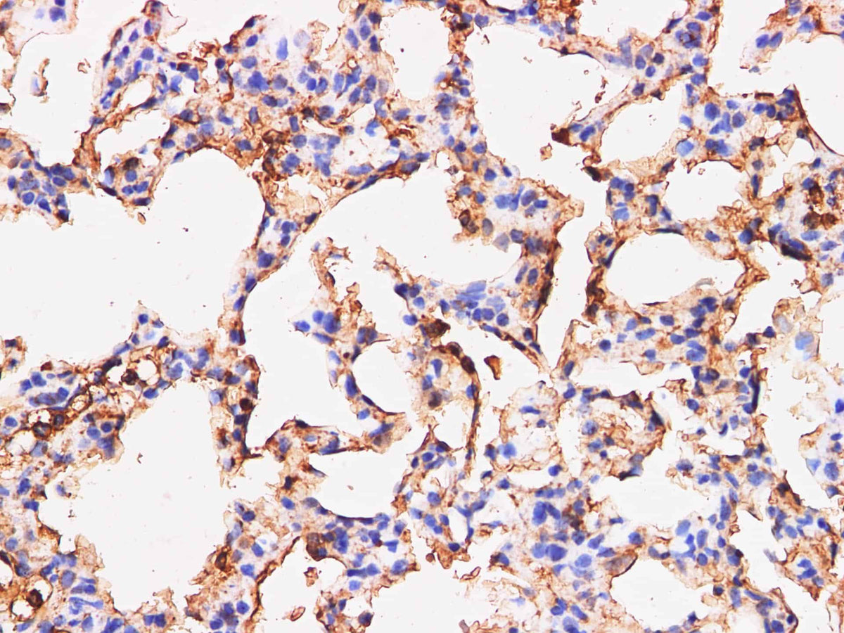 S100A9 Polyclonal Antibody Reactivity Mouse
