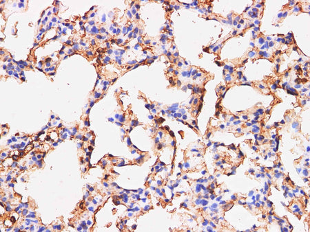 S100A9 Polyclonal Antibody Reactivity Mouse