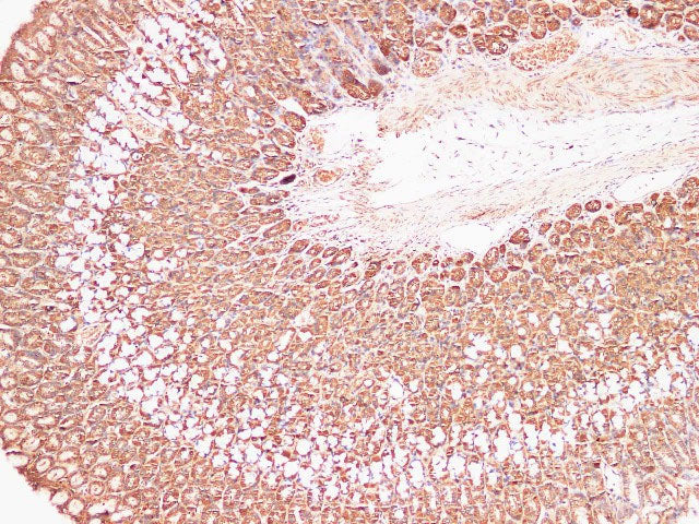 S100A9 Polyclonal Antibody Reactivity Mouse