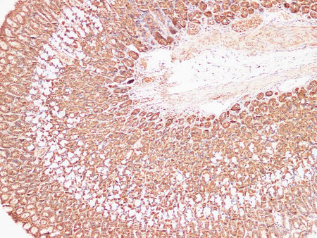 S100A9 Polyclonal Antibody Reactivity Mouse