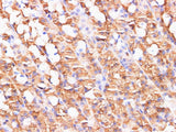S100A9 Polyclonal Antibody Reactivity Mouse