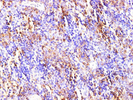 S100A9 Polyclonal Antibody Reactivity Mouse