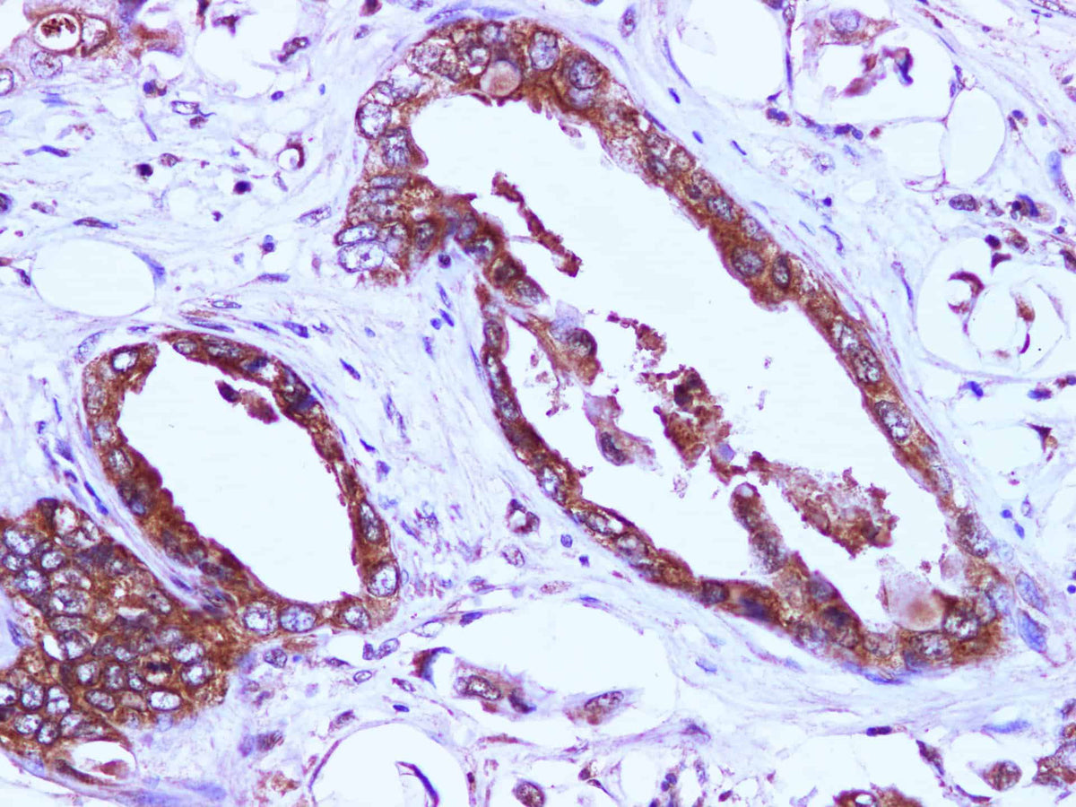 EIF4EBP1 Polyclonal Antibody Reactivity Human