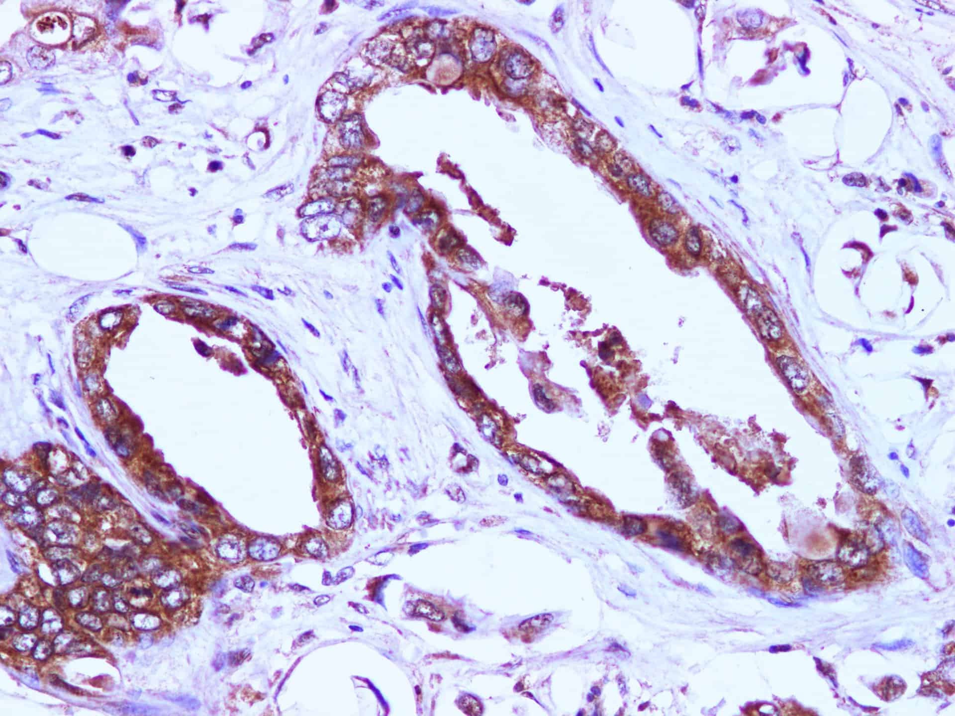 EIF4EBP1 Polyclonal Antibody Reactivity Human
