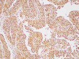 GAPDH Polyclonal Antibody Reactivity Human