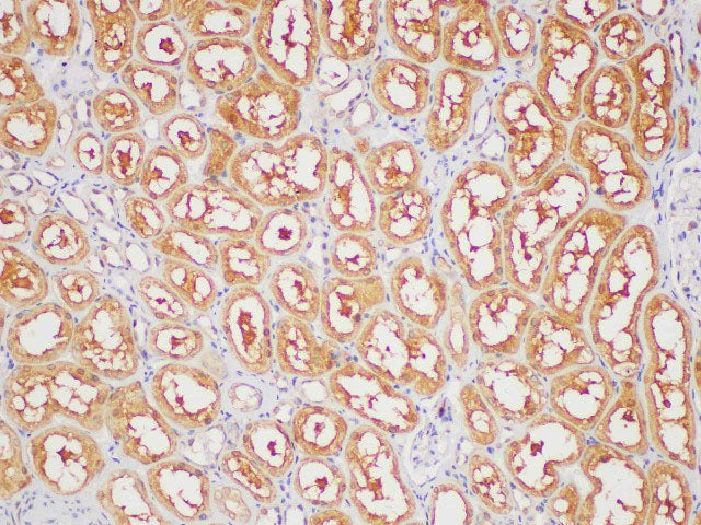 GAPDH Polyclonal Antibody Reactivity Human
