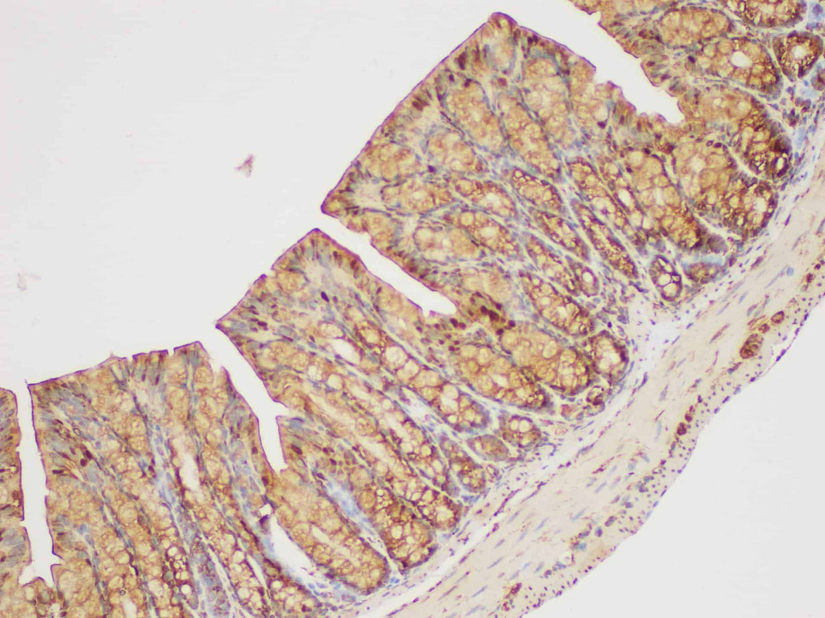 GAPDH Polyclonal Antibody Reactivity Human